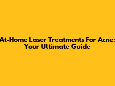 At-Home Laser Treatments For Acne: Your Ultimate Guide