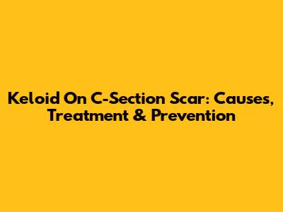 Keloid On C-Section Scar: Causes, Treatment & Prevention