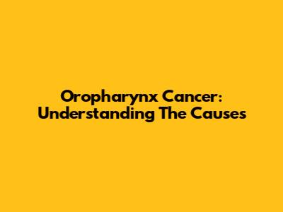 Oropharynx Cancer: Understanding The Causes
