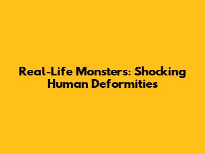 Real-Life Monsters: Shocking Human Deformities
