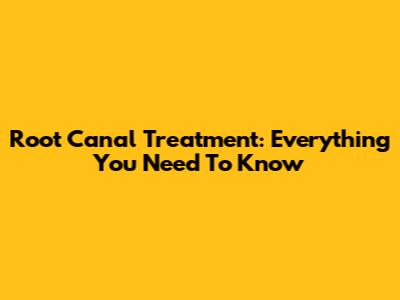 Root Canal Treatment: Everything You Need To Know